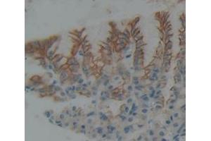 Figure. (BMPR1A antibody  (AA 24-152))