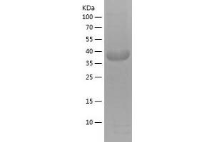 Western Blotting (WB) image for Granulin (GRN) (AA 289-426) protein (His-IF2DI Tag) (ABIN7123192) (Granulin Protein (GRN) (AA 289-426) (His-IF2DI Tag))