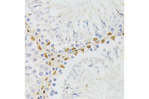 Immunohistochemistry of paraffin-embedded rat testis using EL antibody (ABIN6132052, ABIN6140108, ABIN6140109 and ABIN6222942) at dilution of 1:200 (40x lens). (ELAC2 antibody  (AA 1-270))