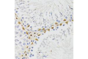 Immunohistochemistry of paraffin-embedded rat testis using EL antibody (ABIN6132052, ABIN6140108, ABIN6140109 and ABIN6222942) at dilution of 1:200 (40x lens). (ELAC2 antibody  (AA 1-270))