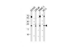 All lanes : Anti-Neurogenin3 Antibody (N-term) at 1:2000 dilution Lane 1: D whole cell lysate Lane 2: LNCap whole cell lysate Lane 3: NC-1 whole cell lysate Lane 4: PC-3 whole cell lysate Lysates/proteins at 20 μg per lane. (Neurogenin 3 antibody  (N-Term))