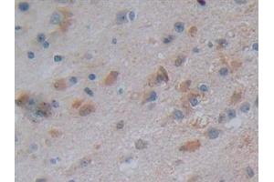 Immunohistochemistry (IHC) image for anti-5'-Nucleotidase, Cytosolic III (NT5C3) (AA 52-336) antibody (ABIN7442483)