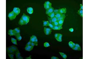 IF analysis of Aldolase/ALDOA using anti-Aldolase/ALDOA antibody (ABIN7601908). (ALDOA antibody  (AA 50-364))