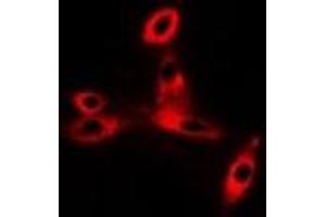 Immunofluorescent analysis of CD47 staining in Hela cells.