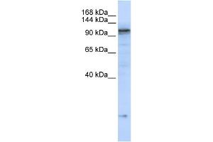 WB Suggested Anti-ATP2A2 Antibody Titration:  0. (ATP2A2 antibody  (C-Term))