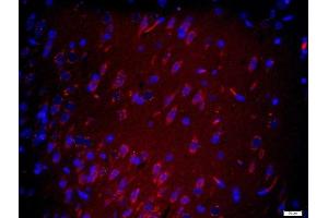 Paraformaldehyde-fixed, paraffin embedded rat brain tissue, Antigen retrieval by boiling in sodium citrate buffer(pH6) for 15min, Block endogenous peroxidase by 3% hydrogen peroxide for 30 minutes, Blocking buffer (normal goat serum) at 37°C for 20min, Antibody incubation with Rabbit Anti-MYCBP2 Polyclonal Antibody, Unconjugated  at 1:400 overnight at 4°C, followed by a conjugated secondary and DAPI staining (MYCBP2 antibody  (AA 60-100))