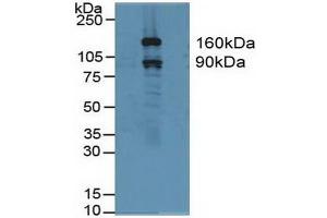 Gelsolin antibody  (AA 577-771)