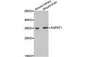 Western blot analysis of extracts of mouse kidney and mouse brain cell lines, using AGPAT1 antibody.