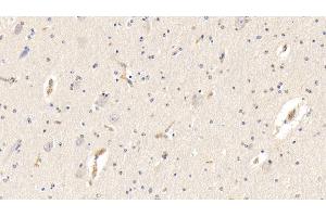 Detection of AHSG in Bovine Cerebrum Tissue using Polyclonal Antibody to Alpha-2-Heremans Schmid Glycoprotein (AHSG) (Fetuin A antibody  (AA 19-359))
