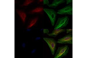 ABIN6261347 and ABIN6278392 staining  cells by IF/ICC. (DOCK2 antibody  (C-Term))