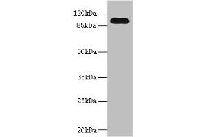 Western blot All lanes: TLR6 antibody at 5 μg/mL + Jurkat whole cell lysate Secondary Goat polyclonal to rabbit IgG at 1/10000 dilution Predicted band size: 92, 56 kDa Observed band size: 92 kDa (TLR6 antibody  (AA 32-586))