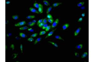 Immunofluorescence staining of Hela cells with ABIN7149787 at 1:166, counter-stained with DAPI. (Desmoglein 3 antibody  (AA 70-615))