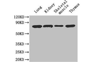 Western Blotting (WB) image for anti-Carboxylesterase 1C (CES1C) (AA 19-550) antibody (ABIN7177073)
