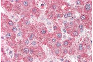 Human Liver (formalin-fixed, paraffin-embedded) stained with MPP6 antibody ABIN337016 at 5 ug/ml followed by biotinylated anti-goat IgG secondary antibody ABIN481715, alkaline phosphatase-streptavidin and chromogen. (MPP6 antibody  (AA 2-14))