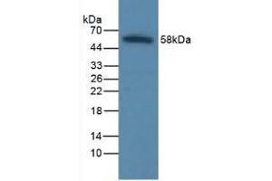 Detection of ICAM1 in Rat Liver Tissue using Polyclonal Antibody to Intercellular Adhesion Molecule 1 (ICAM1) (ICAM1 antibody  (AA 41-464))