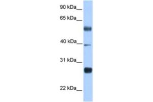 Western Blotting (WB) image for anti-MAX Dimerization Protein 3 (MXD3) antibody (ABIN2461943) (MXD3 antibody)