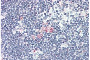 Human Thymus (formalin-fixed, paraffin-embedded) stained with CXCL12 antibody ABIN337163 at 5 ug/ml followed by biotinylated goat anti-rabbit IgG secondary antibody ABIN481713, alkaline phosphatase-streptavidin and chromogen. (CXCL12 antibody)