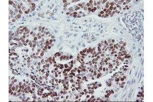 Image no. 8 for anti-Tumor Protein P53 (TP53) antibody (ABIN1499967) (p53 antibody)