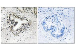 Immunohistochemistry analysis of paraffin-embedded human prostate carcinoma tissue using RPL30 antibody. (RPL30 antibody  (C-Term))