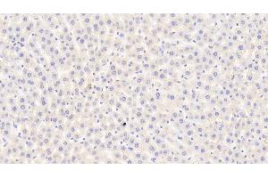 Detection of CPA1 in Rat Liver Tissue using Polyclonal Antibody to Carboxypeptidase A1, Pancreatic (CPA1) (CPA1 antibody  (AA 205-419))