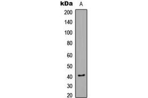 Western blot analysis of CaMK1 alpha (pT177) expression in Jurkat Insulin-treated (A) whole cell lysates. (CAMK1 antibody  (pSer177))