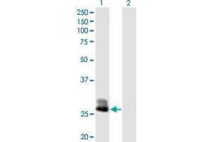 Western Blot analysis of CFHR2 expression in transfected 293T cell line by CFHR2 MaxPab polyclonal antibody. (CFHR2 antibody  (AA 1-270))