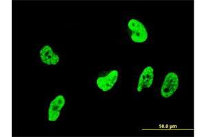 Immunofluorescence of monoclonal antibody to OXSR1 on HeLa cell. (OXSR1 antibody  (AA 351-450))