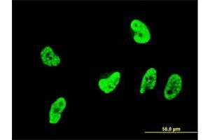 Immunofluorescence of monoclonal antibody to OXSR1 on HeLa cell.