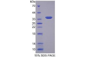 SDS-PAGE analysis of Human CTP Protein. (Slc25a1 Protein)