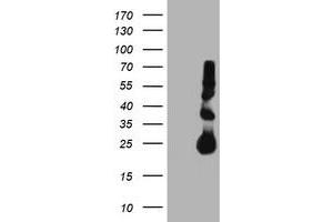 Western Blotting (WB) image for anti-Metalloproteinase Inhibitor 2 (TIMP2) antibody (ABIN1501394) (TIMP2 antibody)