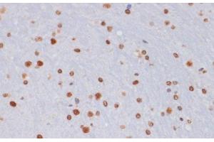 Immunohistochemistry of paraffin-embedded Mouse brain using TriMethyl-Histone H3-K27 Polyclonal Antibody at dilution of 1:100 (40x lens).