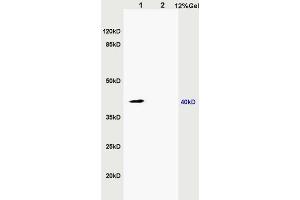L1 rat kidney lysates L2 rat brain lysates probed with Anti ZNF379/ZDHHC9 Polyclonal Antibody, Unconjugated (ABIN715676) at 1:200 in 4 °C.