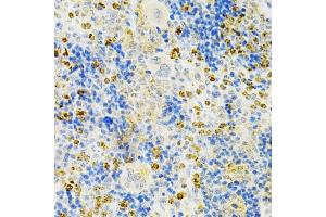 Immunohistochemistry (IHC) image for anti-Tumor Necrosis Factor Receptor Superfamily, Member 11b (TNFRSF11B) (AA 22-280) antibody (ABIN3022915)