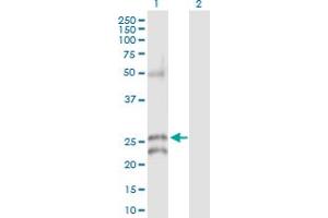 Western Blotting (WB) image for anti-Gap Junction Protein, beta 5, 31,1kDa (GJB5) (AA 1-273) antibody (ABIN516040)