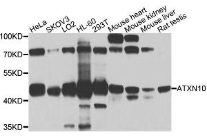 Western blot analysis of extracts of various cell lines, using ATXN10 antibody (ABIN5972628) at 1/1000 dilution. (Ataxin 10 antibody)