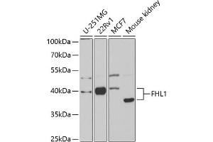 Western Blotting (WB) image for anti-Four and A Half LIM Domains 1 (FHL1) (AA 27-296) antibody (ABIN6140628)