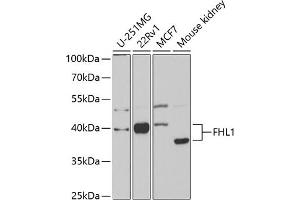 Western blot analysis of extracts of various cell lines, using FHL1 antibody (ABIN6127897, ABIN6140628, ABIN6140629 and ABIN6221119) at 1:1000 dilution. (FHL1 antibody  (AA 27-296))