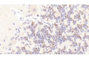 Detection of ANP32A in Human Cerebellum Tissue using Polyclonal Antibody to Acidic Nuclear Phosphoprotein 32 Family, Member A (ANP32A) (PHAP1 antibody  (AA 2-175))