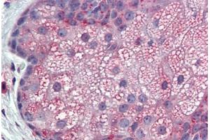 Anti-TM9SF3 antibody IHC staining of skin, sebaceous gland, human. (TM9SF3 antibody  (Internal Region))