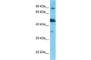 Host:  Rabbit  Target Name:  NSUN2  Sample Type:  PANC1 Whole Cell lysates  Antibody Dilution:  1. (NSUN2 antibody  (N-Term))