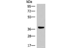 Western blot analysis of Mouse liver tissue lysate using LRG1 Polyclonal Antibody at dilution of 1:1000 (LRG1 antibody)