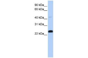 WB Suggested Anti-LYCAT Antibody Titration:  0. (LCLAT1 antibody  (Middle Region))