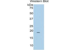 Western Blotting (WB) image for RalA Binding Protein 1 (RALBP1) ELISA Kit (ABIN6730973)