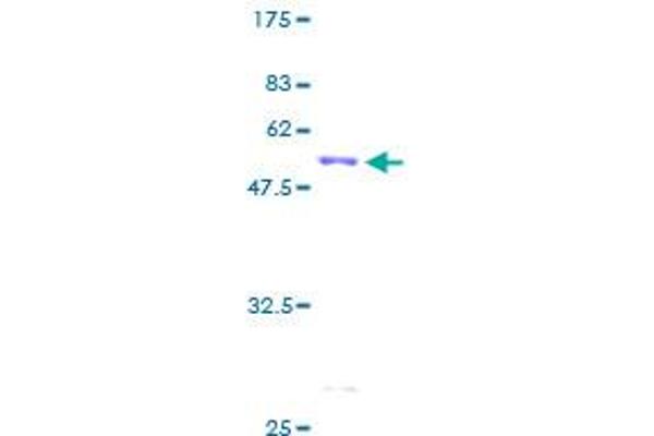 CA1 Protein (AA 1-261) (GST tag)