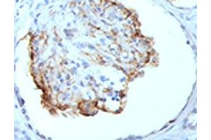 IHC testing of formalin-fixed, paraffin-embedded human kidney stained with WT1 antibody (clone WT1/857). (WT1 antibody)