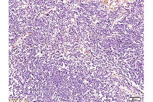 Immunohistochemistry (IHC) image for anti-Breast Cancer Metastasis-Suppressor 1-Like (BRMS1L) (AA 151-246) antibody (ABIN730933)