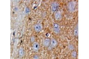 #VALUE! (GREM1 antibody  (AA 25-184))