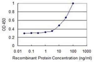 Detection limit for recombinant GST tagged AKTIP is 1 ng/ml as a capture antibody. (AKTIP antibody  (AA 1-292))