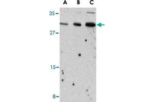 Western blot analysis of Il31 in Raw 264.