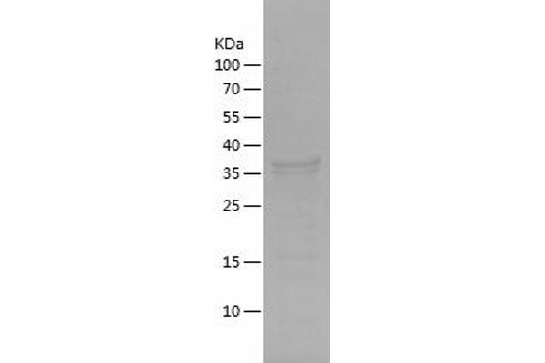 KRT20 Protein (AA 1-139) (His-IF2DI Tag)